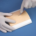 wound closure pads