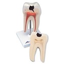 dental model