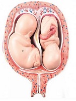 5th-Month-Twin-Fetuses