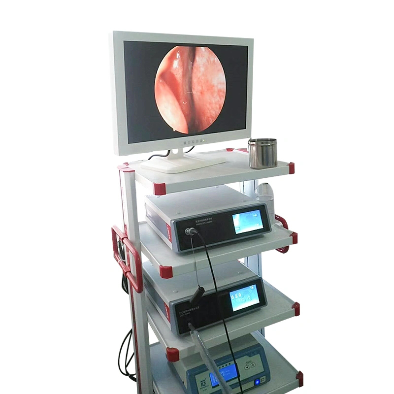 Medical Endoscope Camera System Laparoscopy for Hospital