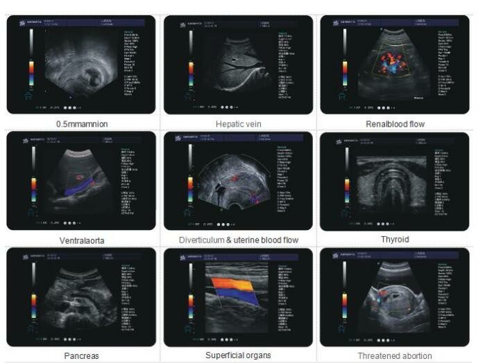 15' LED 3D 4D Laptop Ultrasonic Scanner portable ultrasound machine color doppler Systems